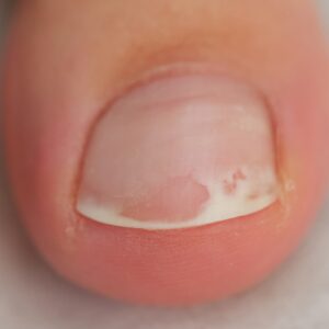 Image-EBX-Derma-06 (1)